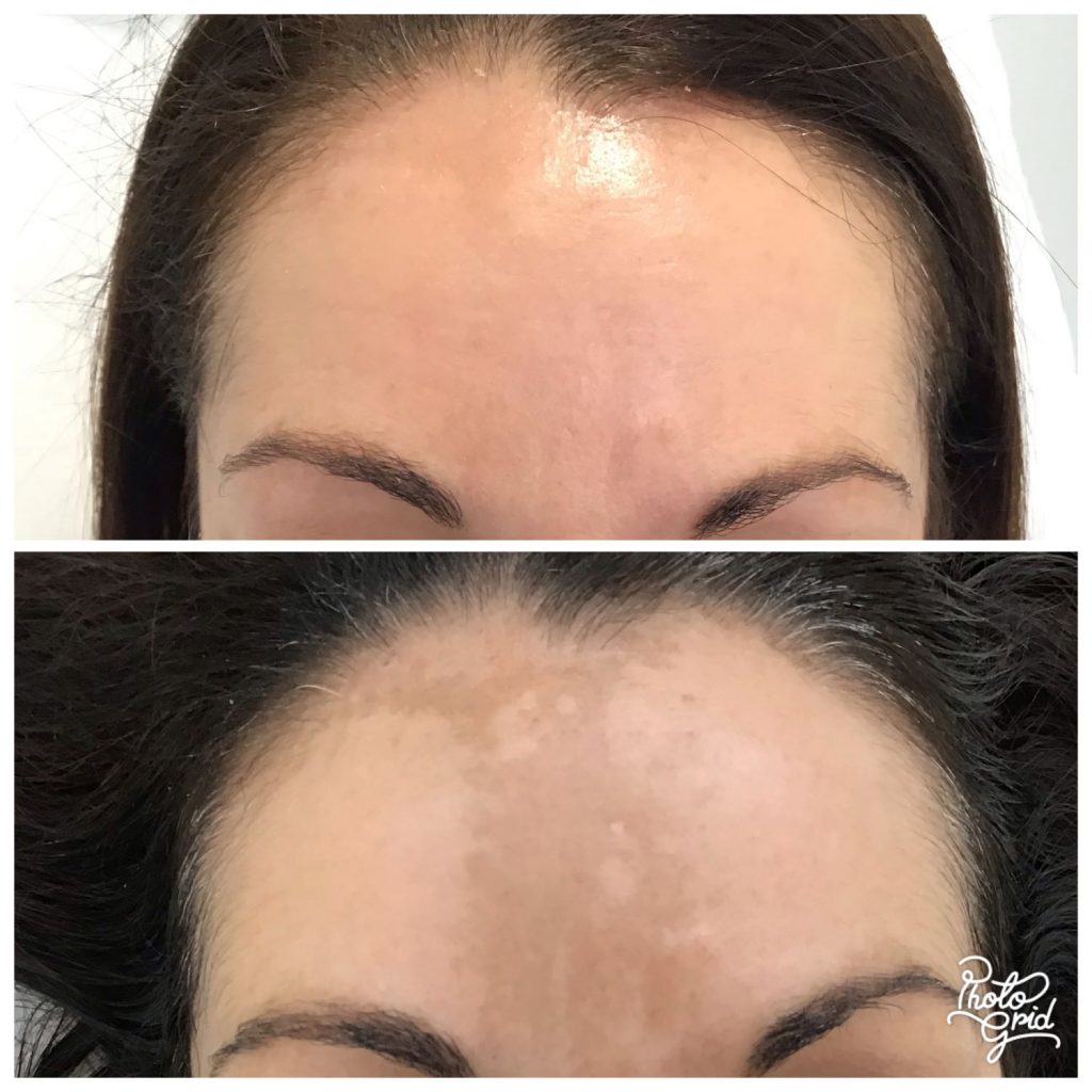 medicina estética facial Madrid