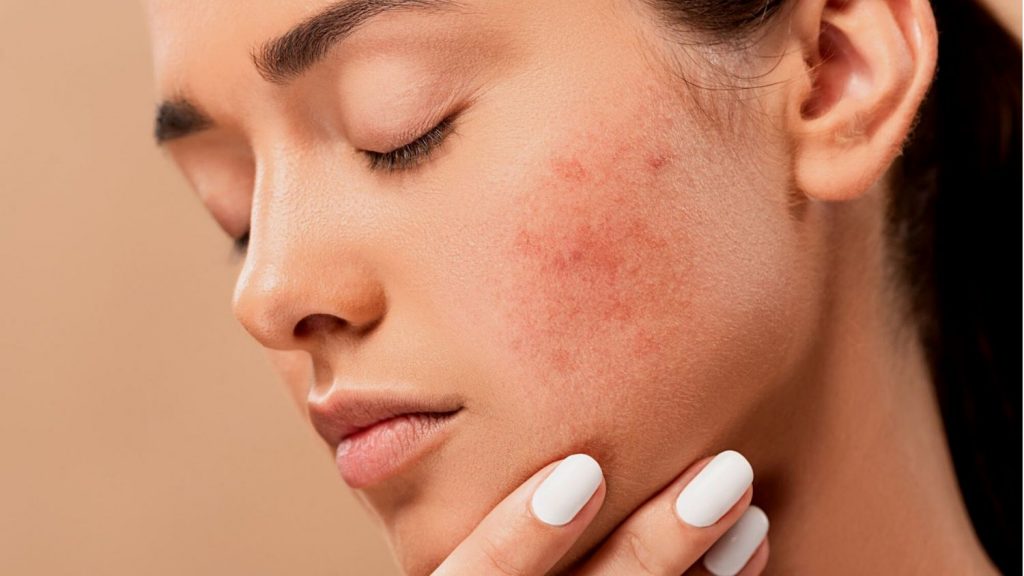 medicina estética facial Madrid
