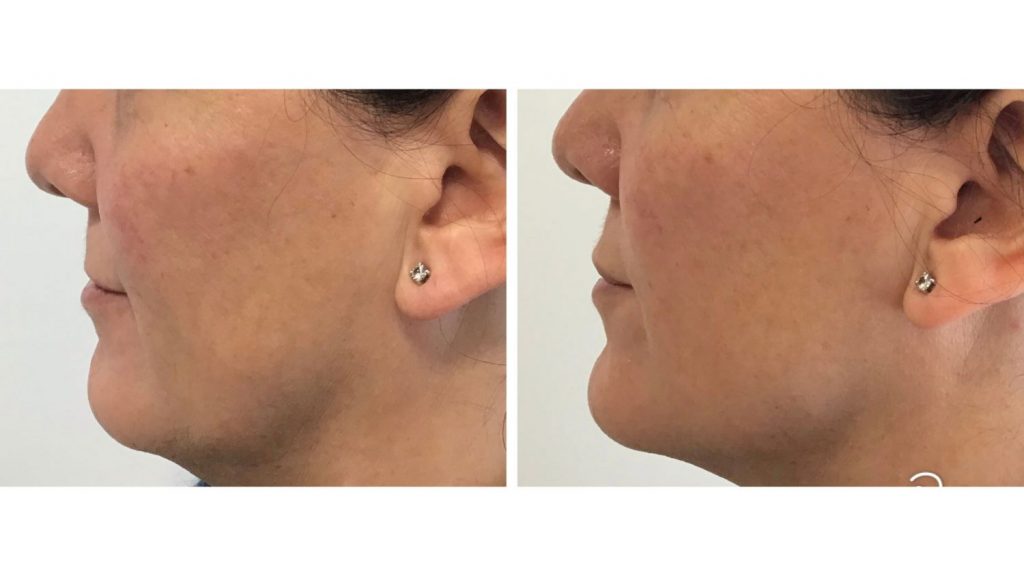 medicina estética facial Madrid
