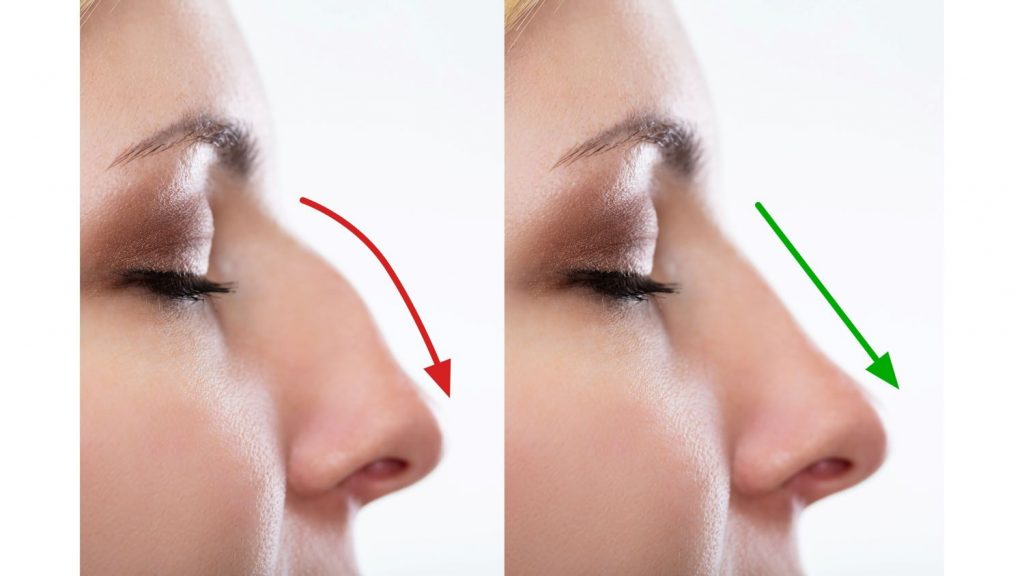 medicina estética facial Madrid