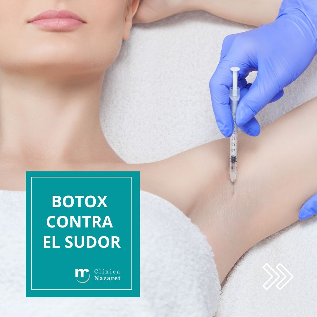 botox contra el sudor