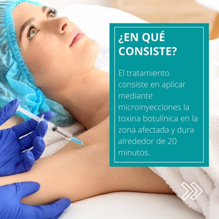 botox contra el sudor