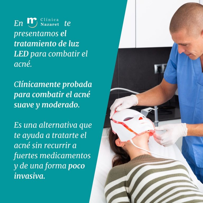 tratamientos antiacné